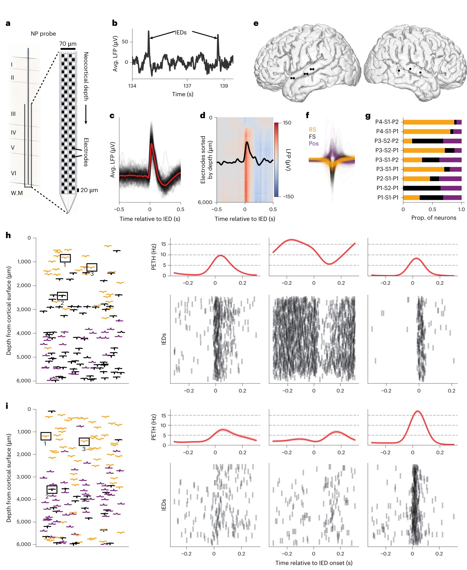 Silva 等 2026 原文 Figure 1：Neuropixels 跨层记录和 IED 对齐后的单神经元反应