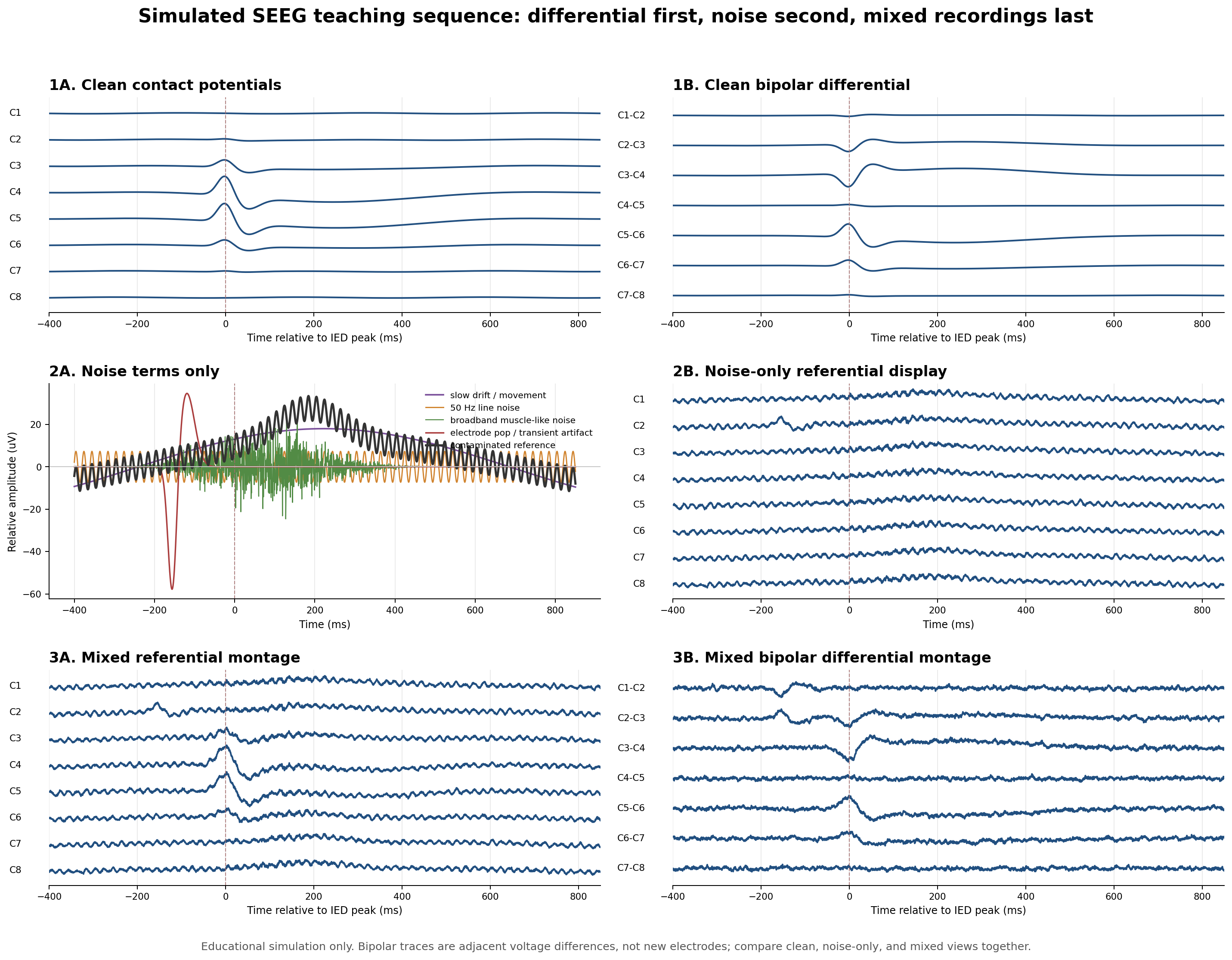 Simulated SEEG noise reference differential schematic