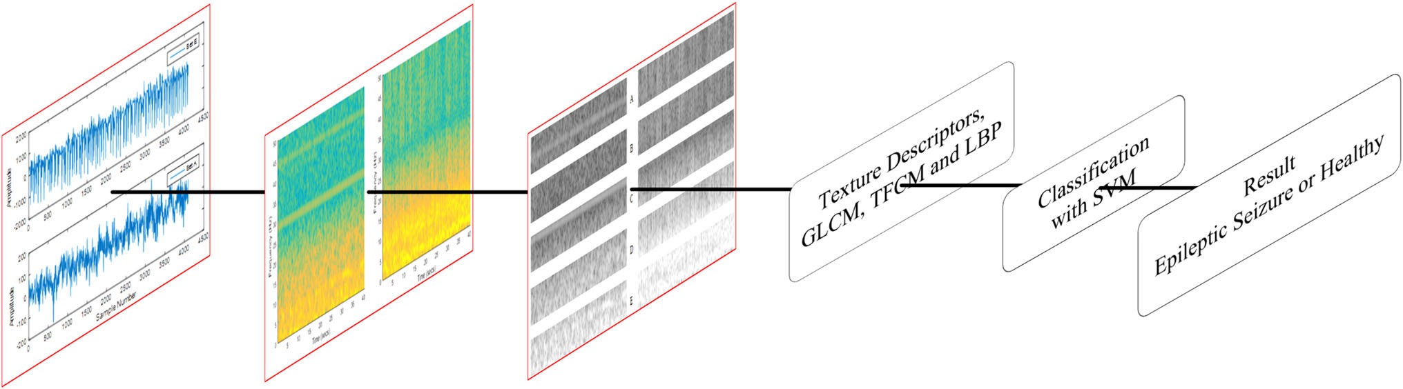 Sengur 等原文 Figure 1：时频纹理分类流程