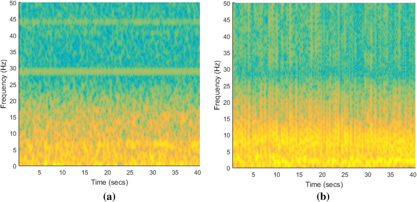 Sengur 等原文 Figure 6：健康与癫痫发作 EEG 的 spectrogram 对比